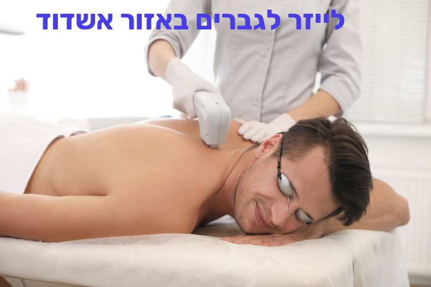 הסרת שיער בלייזר לגברים באזור אשדוד